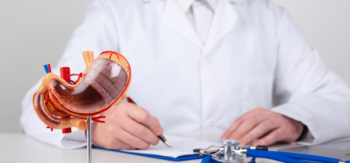 Sleeve Gastrectomy Napoli