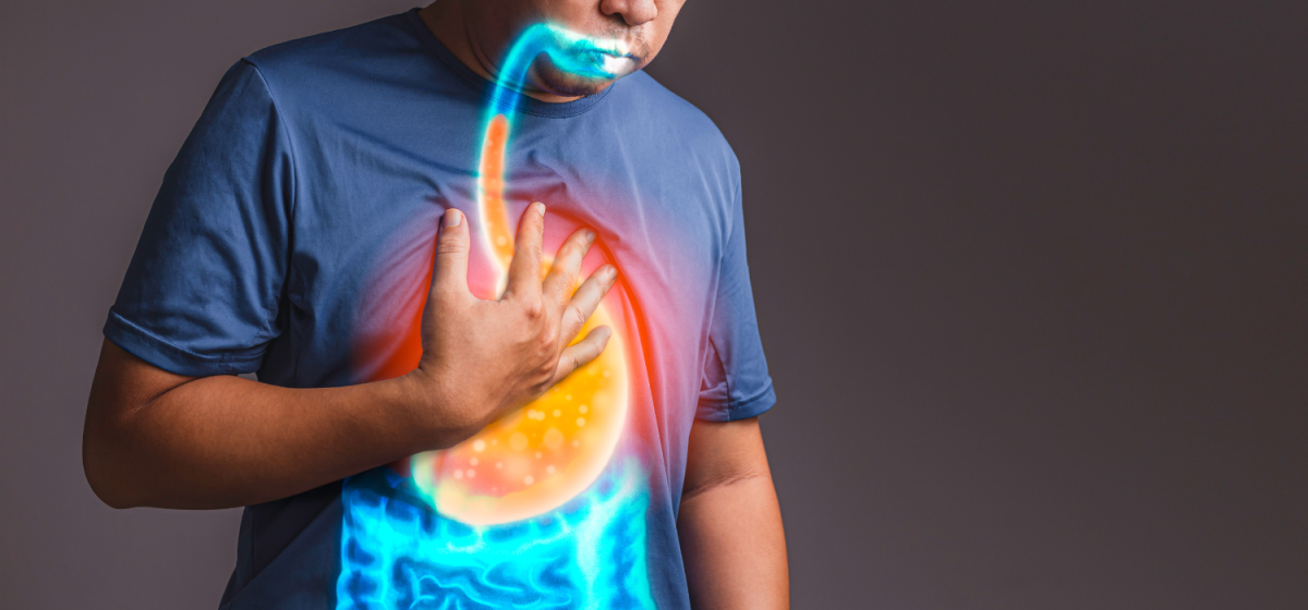 Reflusso Gastroesofageo Napoli